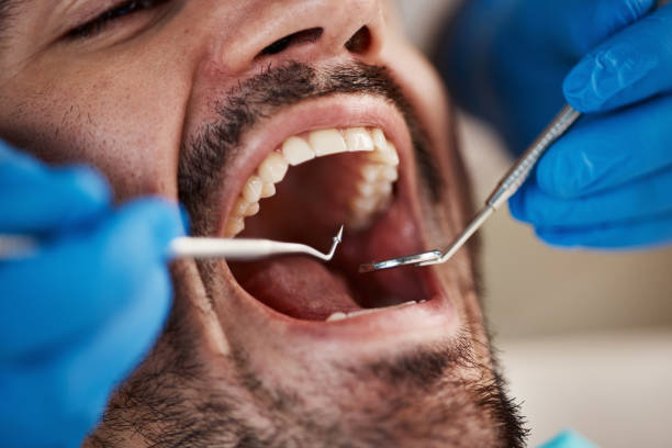 Best Emergency Dentist for Knocked-Out Tooth in Pompton Lakes, NJ